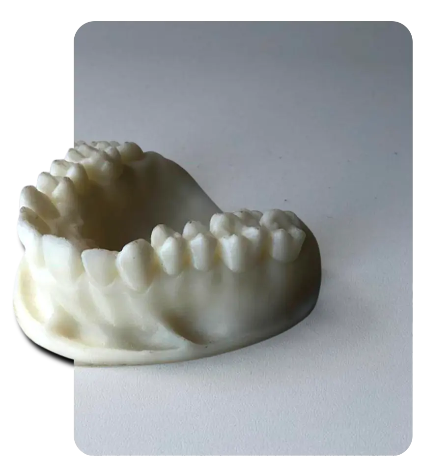 Impressão 3D - Tecnologia assistiva