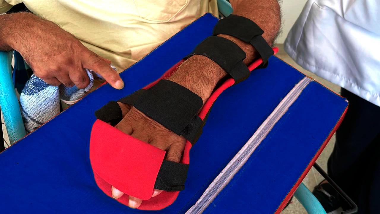 Impressão 3D - Tecnologia assistiva